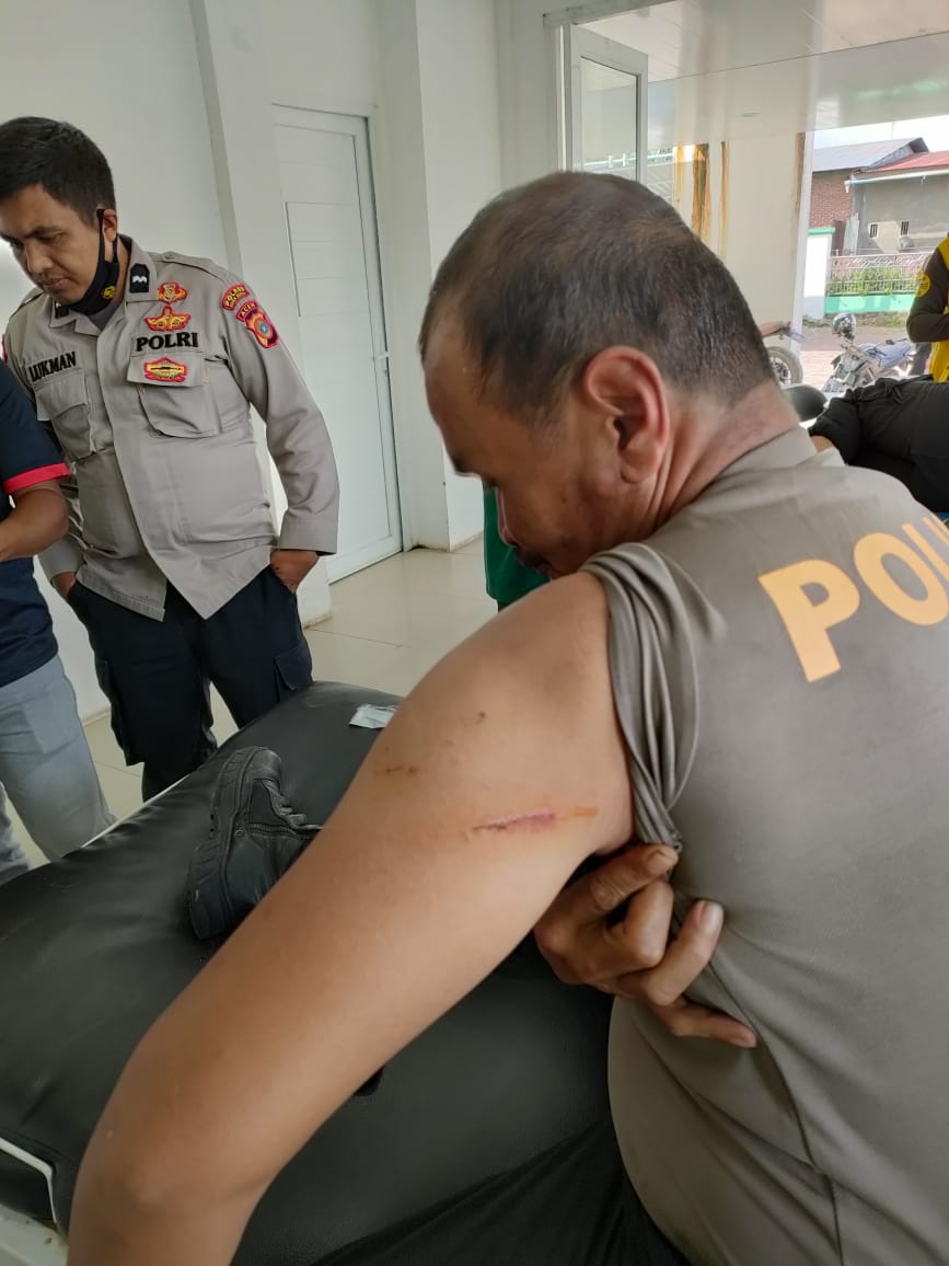Dua Polisi Korban Bacok ODGJ Dua Polisi Korban Bacok ODGJ
