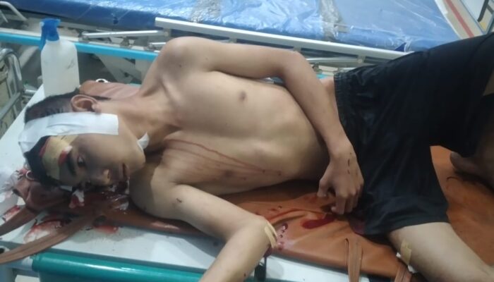 Kawanan Begal Di Belawan Bacok Pengendara Sepedamotor