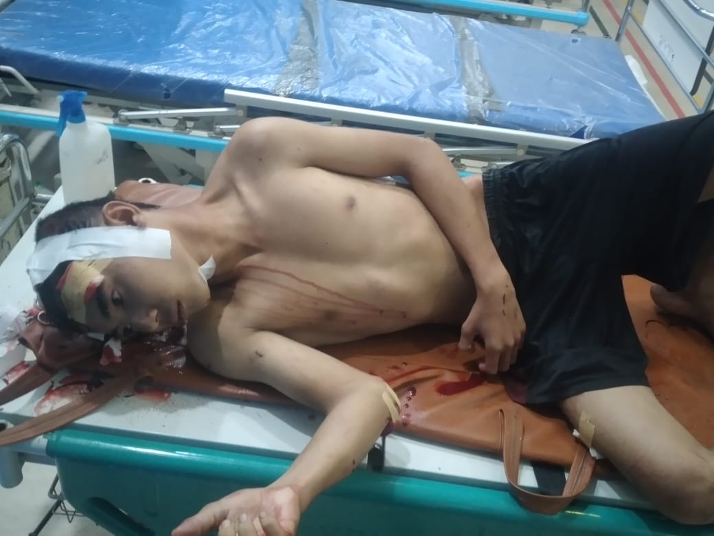 Kawanan Begal Di Belawan Bacok Pengendara Sepedamotor