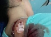 Wanita Terkapar Kena Clurit Begal di Jl. Cemara Abadi