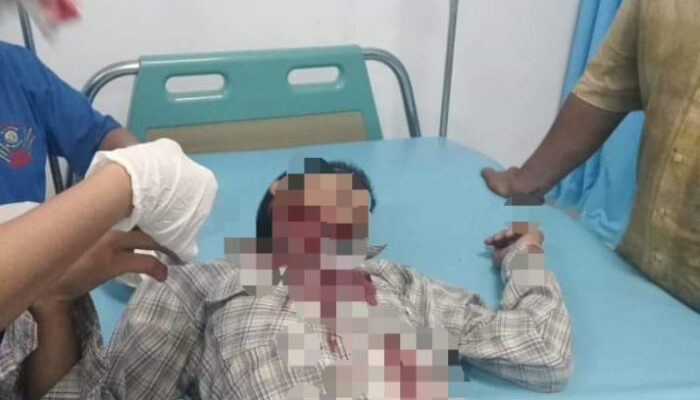 Diduga Masalah Tawuran, Rahmad Dibacok OTK Di Belawan