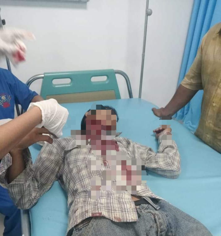 Diduga Masalah Tawuran, Rahmad Dibacok OTK Di Belawan