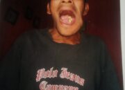 Pria Miskin Hutapuli Penderita Tumor Meringis Kesakitan