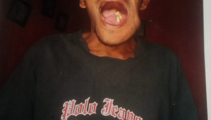 Camat Siabu Minta Bantu Warga Miskin Penderita Tumor