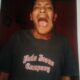 Tongku Saleh, 39, menderita penyakit tumor menggerogoti bagian rongga mulutnya. Waspada.id/dok