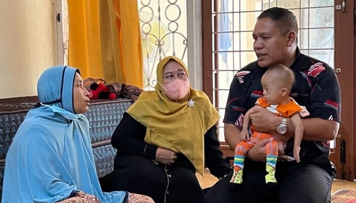 Bupati Abdya Bantu Balita Bocor Jantung