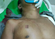 Mantan Anggota DPRD Langkat Tewas Ditembak