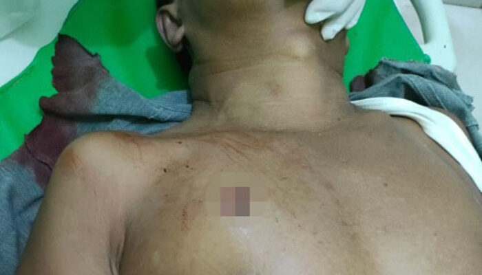 Mantan Anggota DPRD Langkat Tewas Ditembak