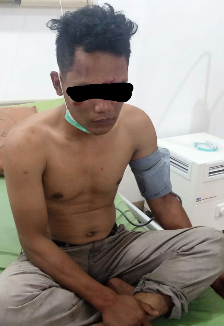 Jambret Babak Belur Kena Hajar Massa Di P.Siantar