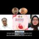 Deteksi Dini Ketahui Jantung Bocor Bawaan Pada Anak
