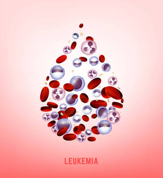 Leukimia Jenis Kanker Terbanyak Serang Anak di Sumut