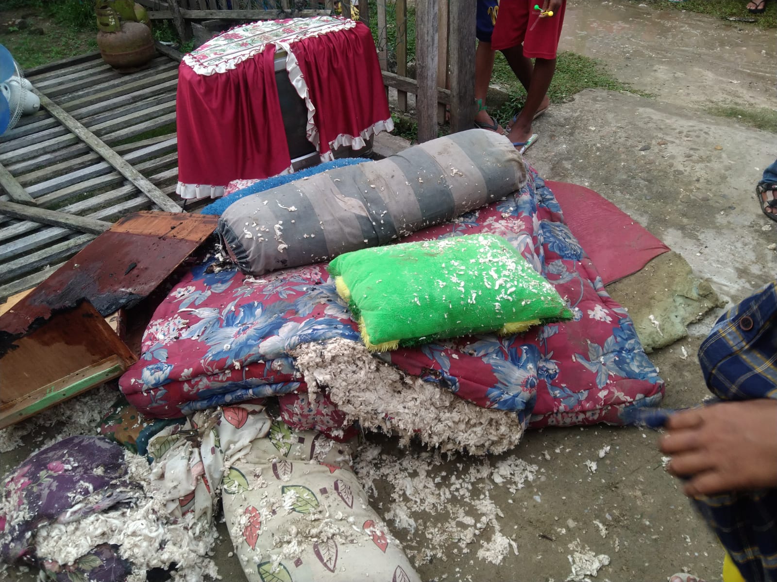 Bocah Korban Kebakaran Jalani Operasi Kedua Di RSUZA