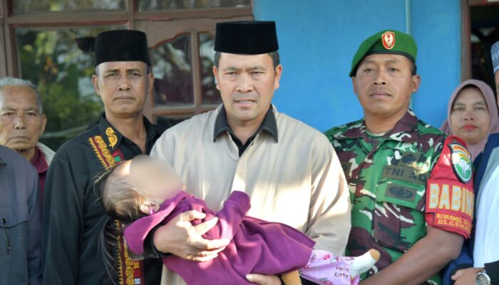 Pj Bupati Haili Yoga Sambangi Balita Penderita Hidrosefalus