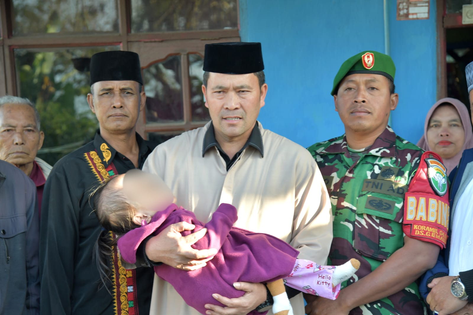 Pj Bupati Haili Yoga Sambangi Balita Penderita Hidrosefalus