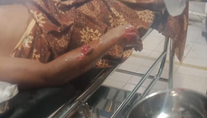 Di Madina, Selamatkan Istri Dari Terkaman Buaya, Hendri Luka-luka