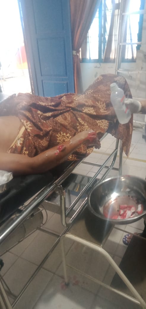 Di Madina, Selamatkan Istri Dari Terkaman Buaya, Hendri Luka-luka