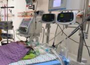 Bayi Kembar Siam di RSUP HAM Butuh Donor ASI