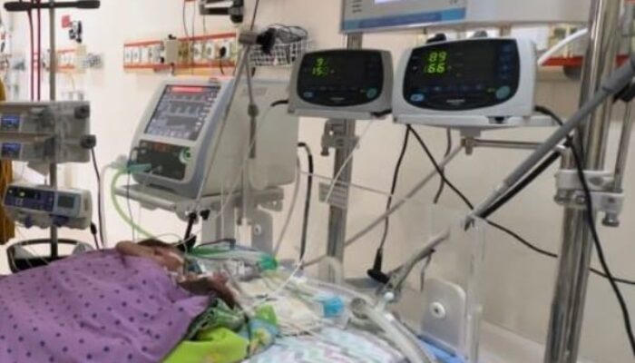 Bayi Kembar Siam di RSUP HAM Butuh Donor ASI
