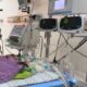 Bayi Kembar Siam di RSUP HAM Butuh Donor ASI