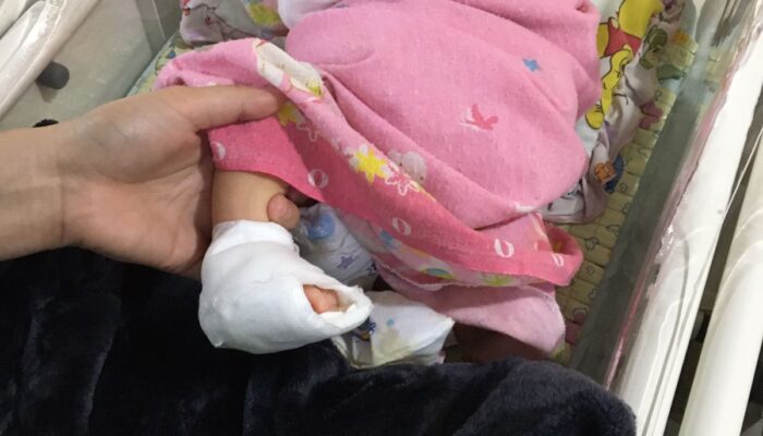 Seorang Bayi Di Medan Diduga Jadi Korban Malpraktek