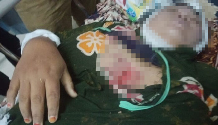 Janda Umur 30-an Diduga Korban Pembunuhan, Tersangka Belum Ditemukan