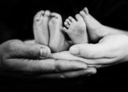 Bayi Kembar Siam Asal Batubara Hasan Dan Husin Meninggal Dunia