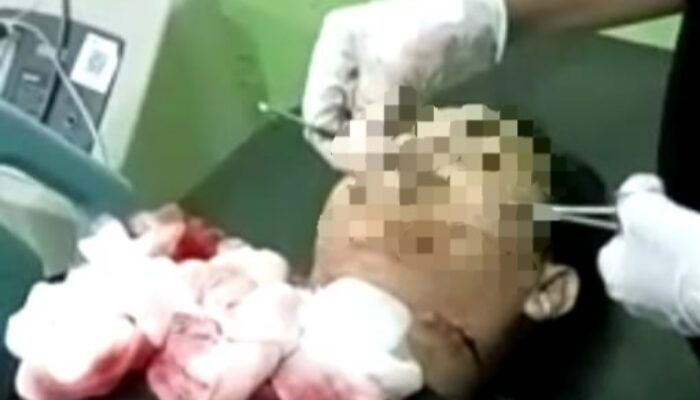 Nabrak Kerbau, Seorang Pengendara Sepedamotor Tewas Di Simeulue