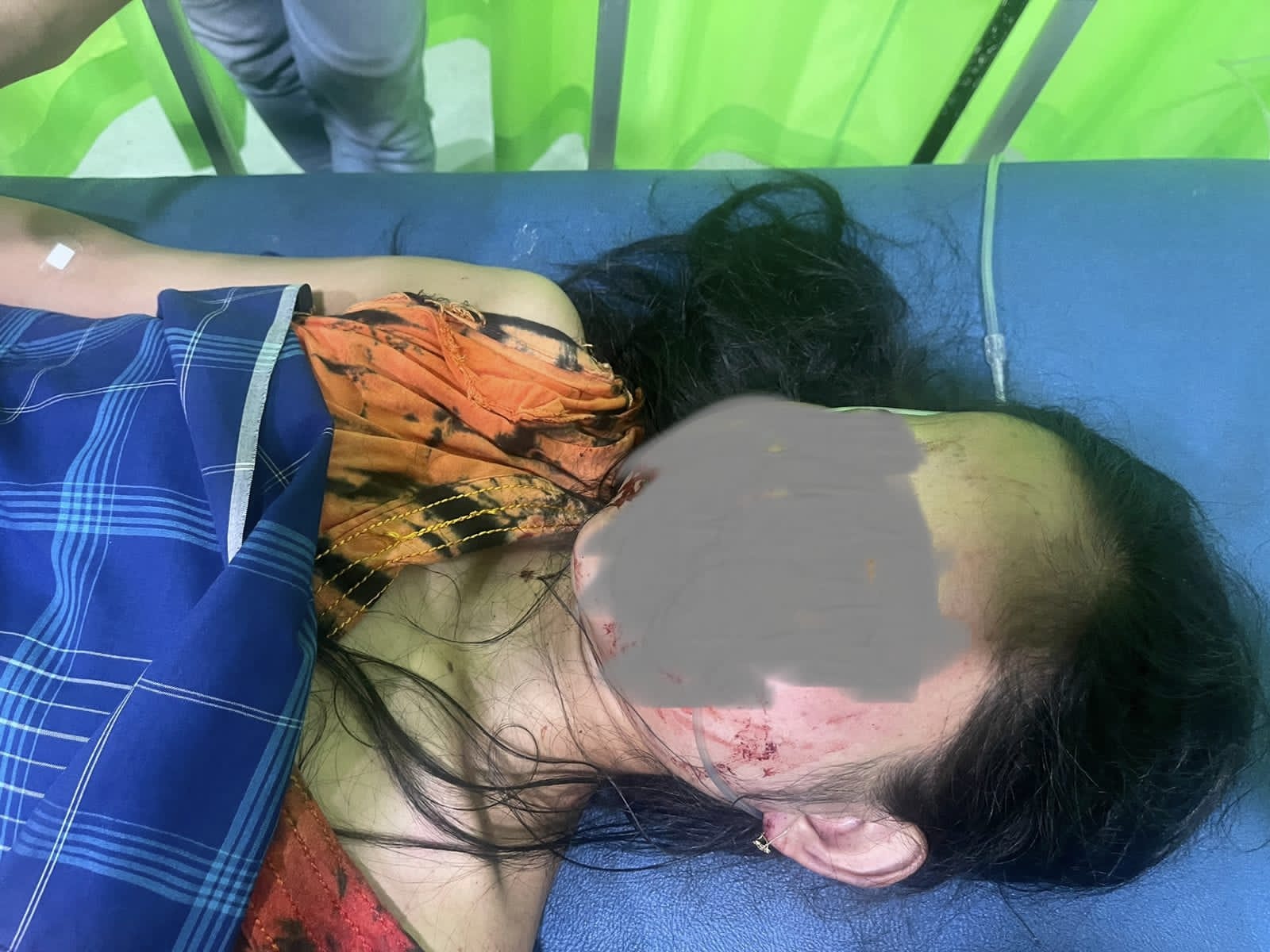 Di Langsa, Suami Kerja, Istri Dirampok Dan Dianiaya