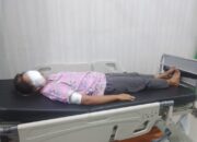 Boncengan Dengan Pria Lain, Wajah ABG Disayat Kekasihnya