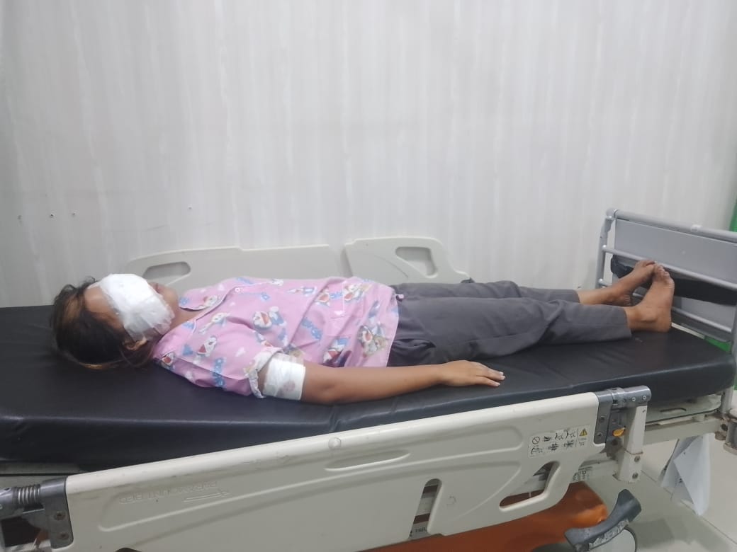 Boncengan Dengan Pria Lain, Wajah ABG Disayat Kekasihnya