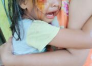 Tabrak Lari, 1 Anak Dan Balita Alami Trauma Dan Luka Berat