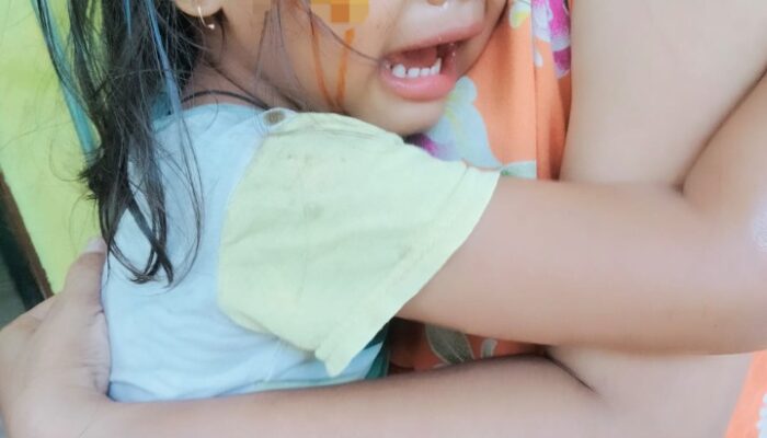 Tabrak Lari, 1 Anak Dan Balita Alami Trauma Dan Luka Berat