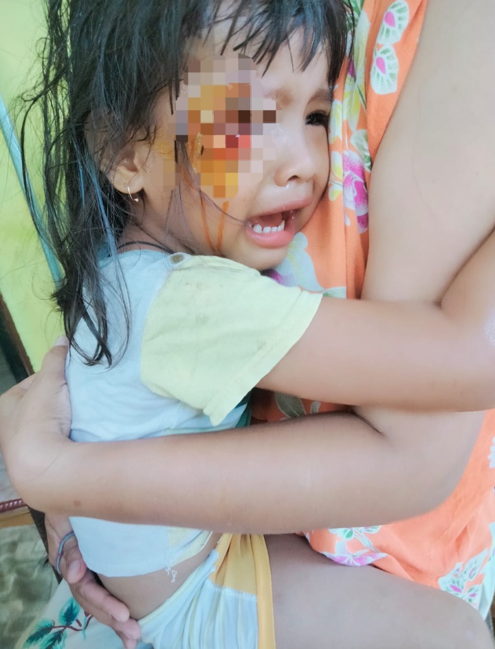 Tabrak Lari, 1 Anak Dan Balita Alami Trauma Dan Luka Berat