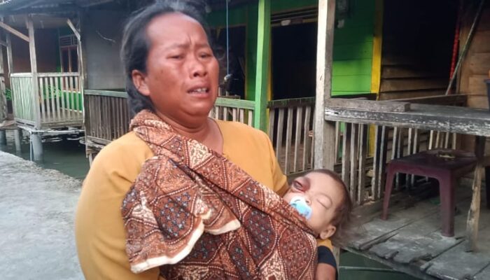 Butuh Biaya Operasi, Balita di Batubara Butuh Uluran Tangan Dermawan