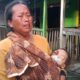 Butuh Biaya Operasi, Balita di Batubara Butuh Uluran Tangan Dermawan