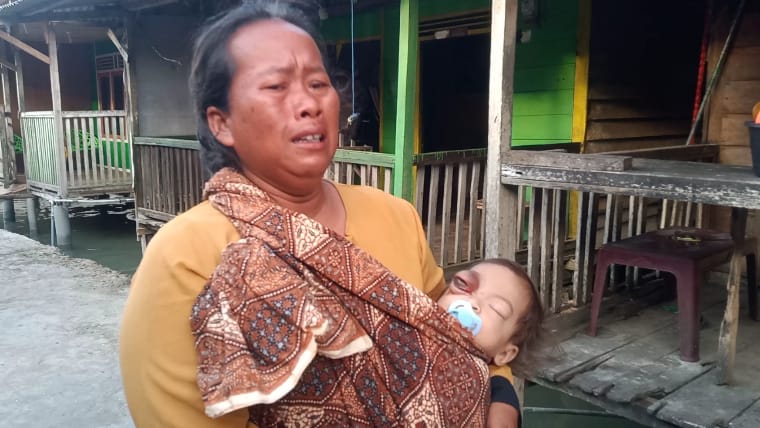 Butuh Biaya Operasi, Balita di Batubara Butuh Uluran Tangan Dermawan