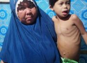 Bocah Penderita Jantung Bocor Segera Diterbangkan Ke Jakarta