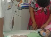 Alifah, Balita Tanjungtiram Menderita Pembengkakan Mata Jalani Perawatan