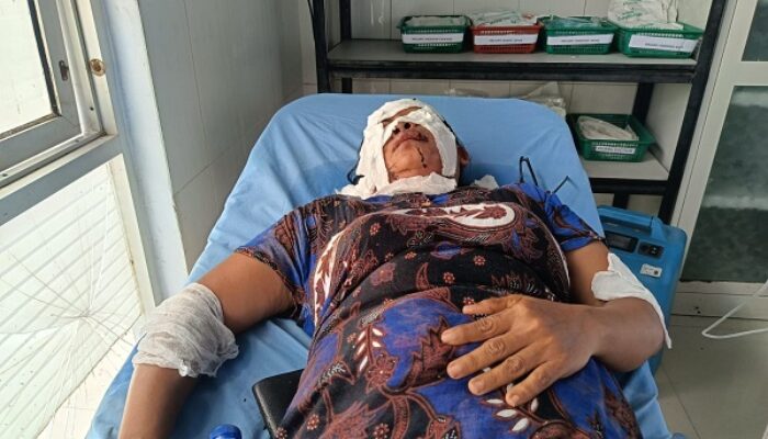 Melarikan Diri, Pelaku Penyiraman Air Keras Terus Diburu