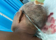 Anak Tega Aniaya Ayah Hingga Kritis