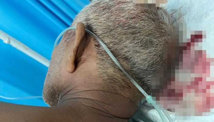 Anak Tega Aniaya Ayah Hingga Kritis