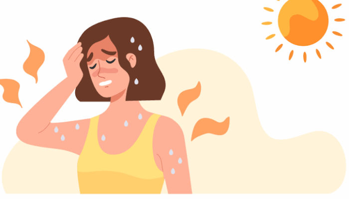 Waspadai Heatstroke Akibat Cuaca Panas