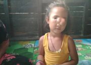 Nasib Gadis Cilik Simangambat, Butuh Bantuan