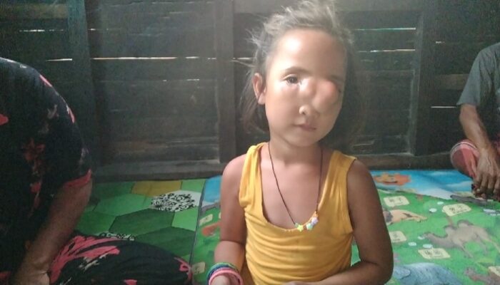 Nasib Gadis Cilik Simangambat, Butuh Bantuan