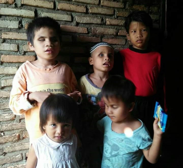 Anak Pidolidolok Sekeluarga Buta Total, Mohon Bantuan