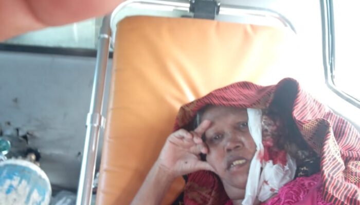 Pj Bupati Agara Bantu Penderita Kanker Kepala