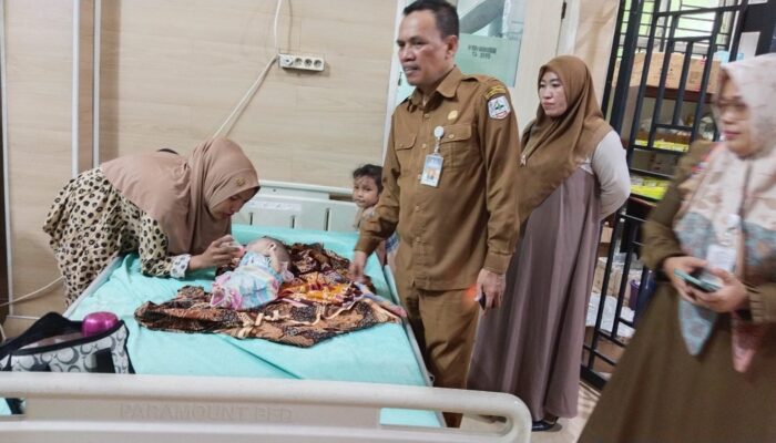 RSUZA Operasi Bocah Pengidap hidrosefalus