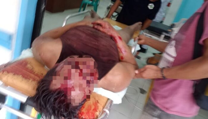 Pelaku Curas Babak Belur Dihakimi Massa