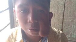 Nasaruddin, 11, warga Desa Tanjungjae, Kec. Panyabungan Timur, Madina, hendak operasi di Medan pakai BPJS butuh biaya transportasi dan biaya hidup sehari-hari. Waspada/Ist