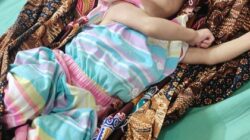 Kondisi Balita penderita hidrosefalus saat ini. Waspada/Seh Muhammad Amin
